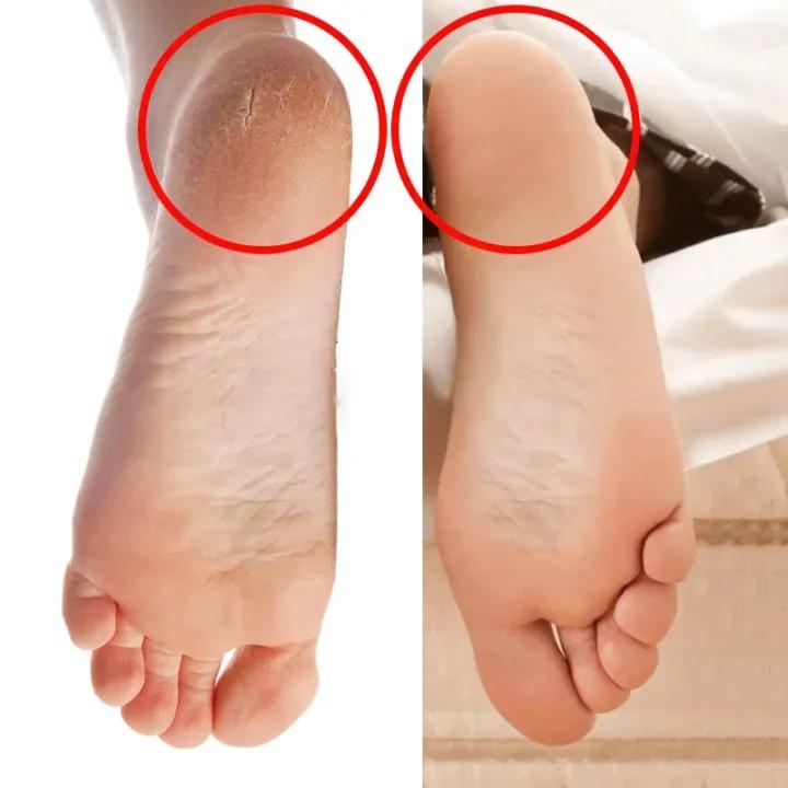 Anti-Crack Heel Socks Silicone Beige Unisex